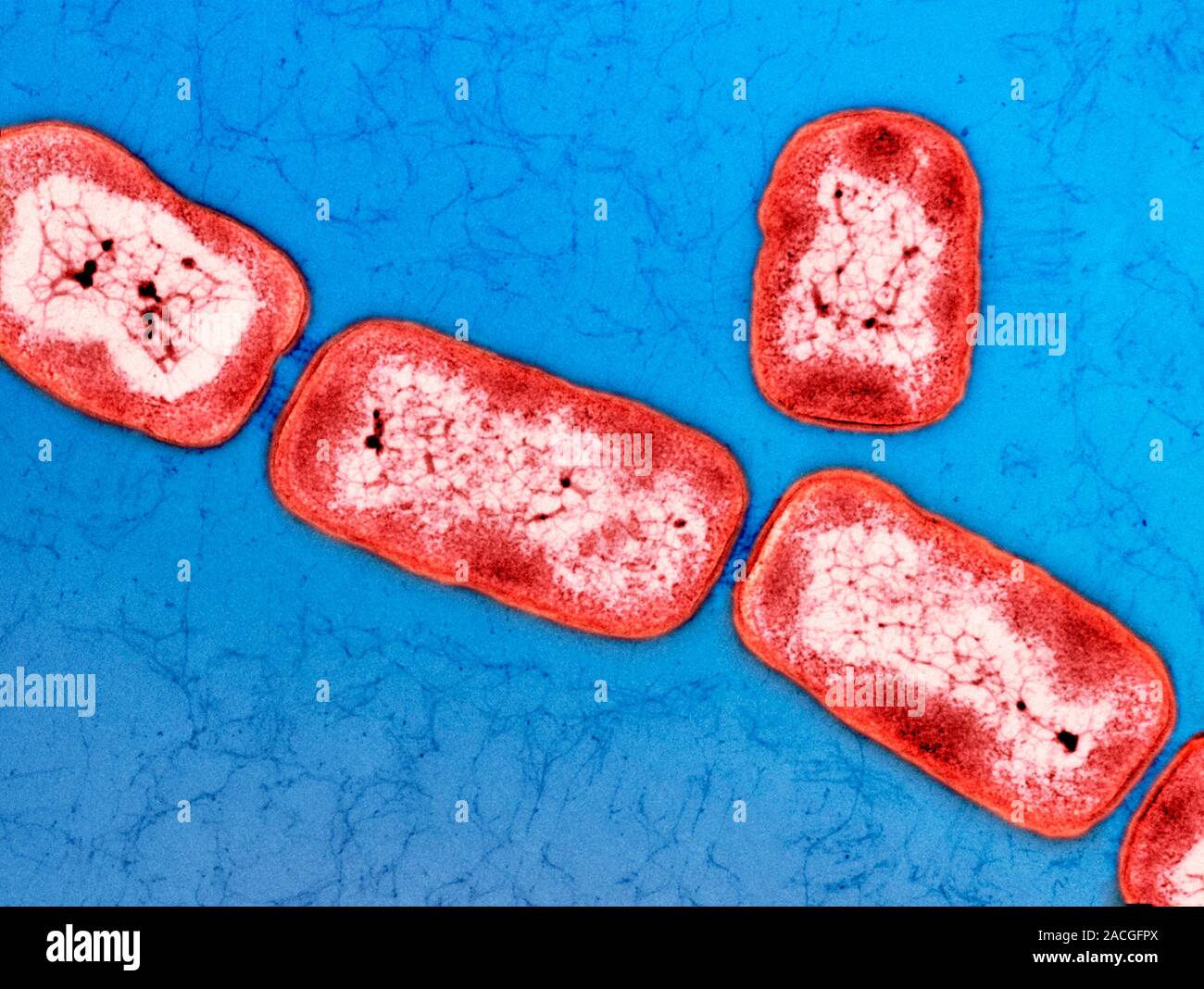 Vitreoscilla bacteria. Coloured transmission electron micrograph (TEM