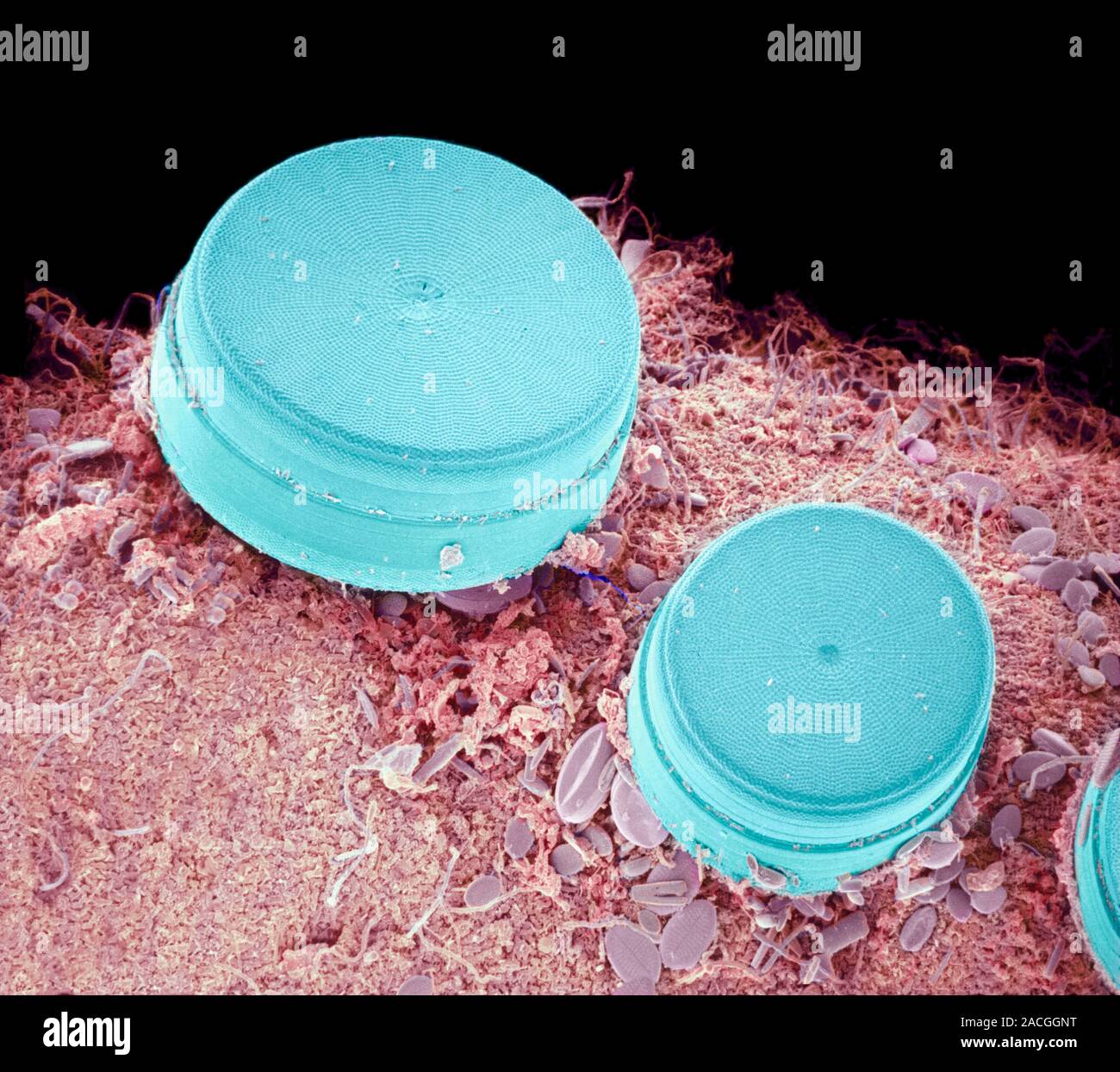 Diatoms. Coloured scanning electron micrograph (SEM) of marine diatoms ...