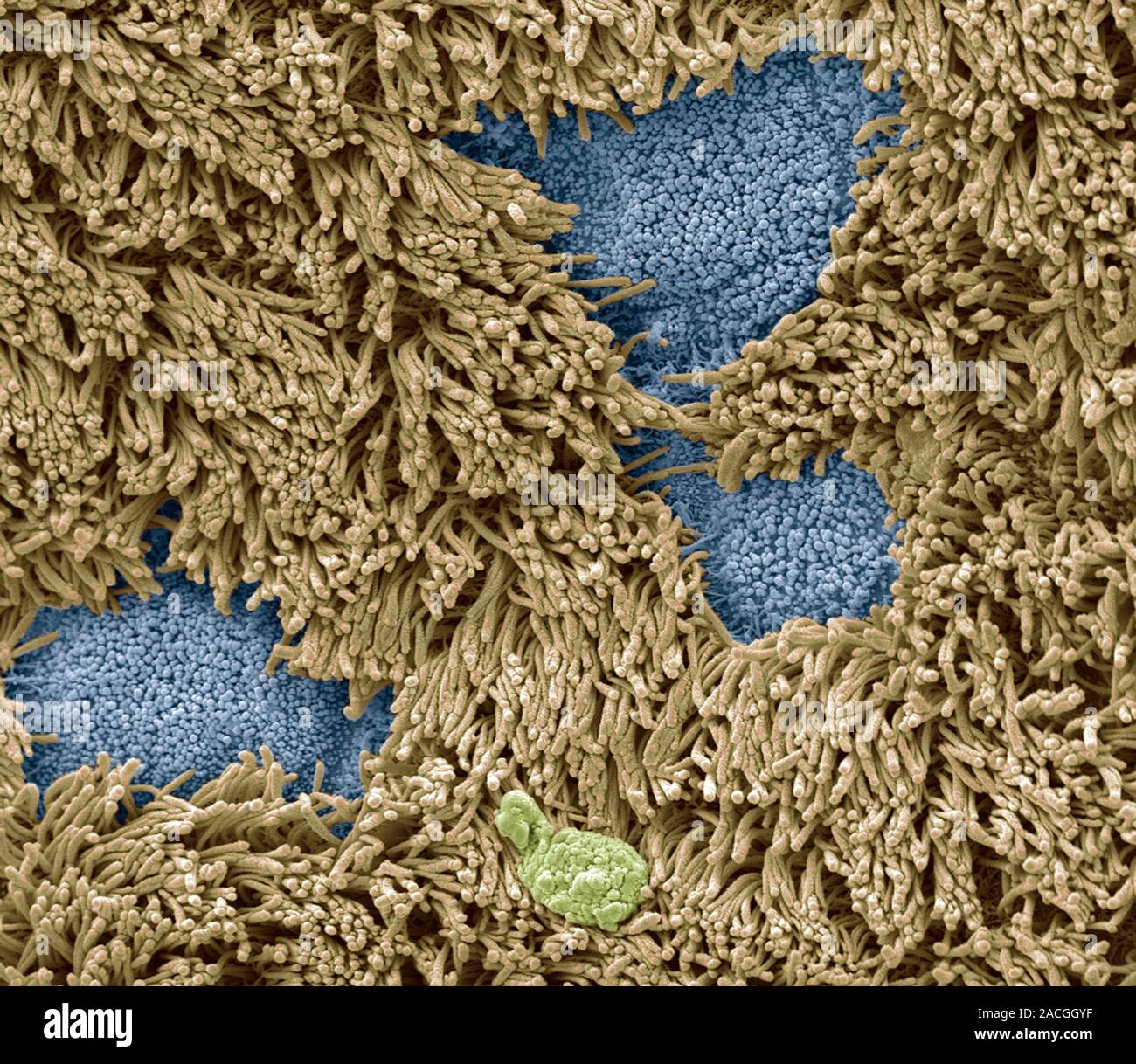 Nasal epithelium, coloured scanning electron micrograph (SEM). The ...