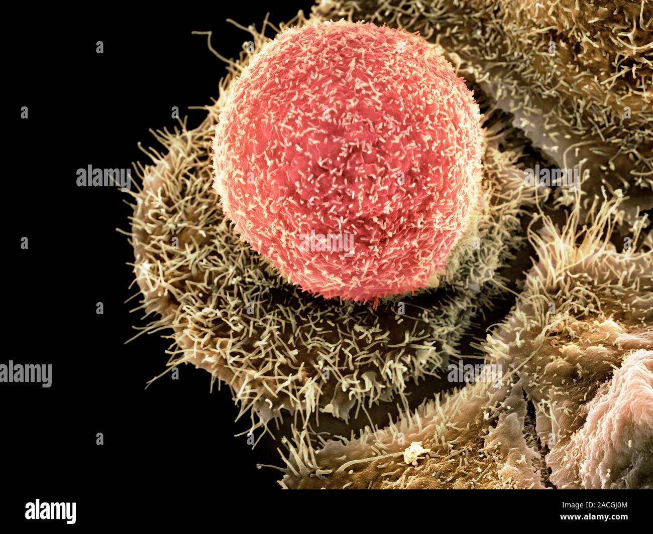 Хламидии 4. Хламидия трахоматис под микроскопом. Хламидиоз трахоматис микроскоп.