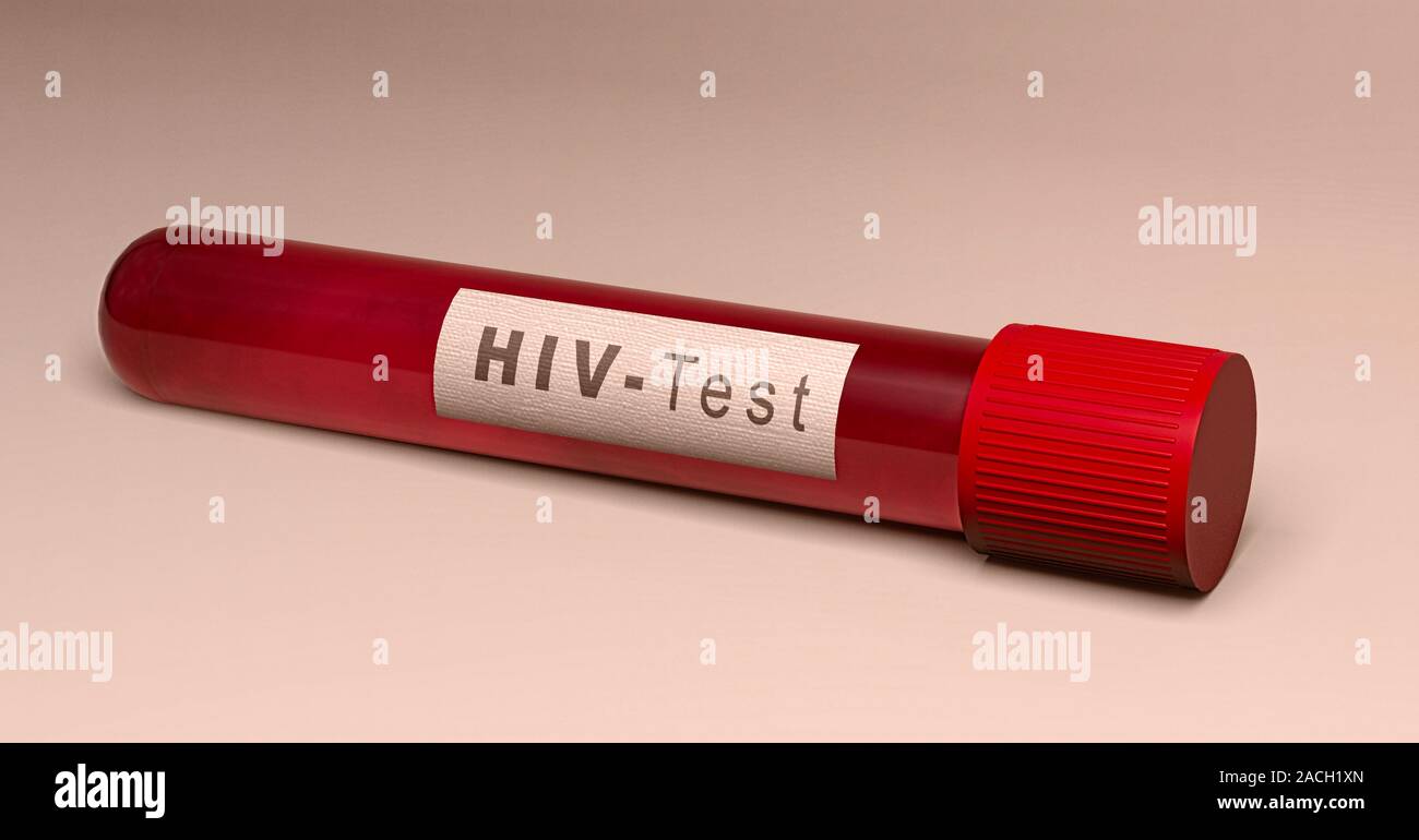 Test of the HIV virus, blood tube. Analysis to find out if you are