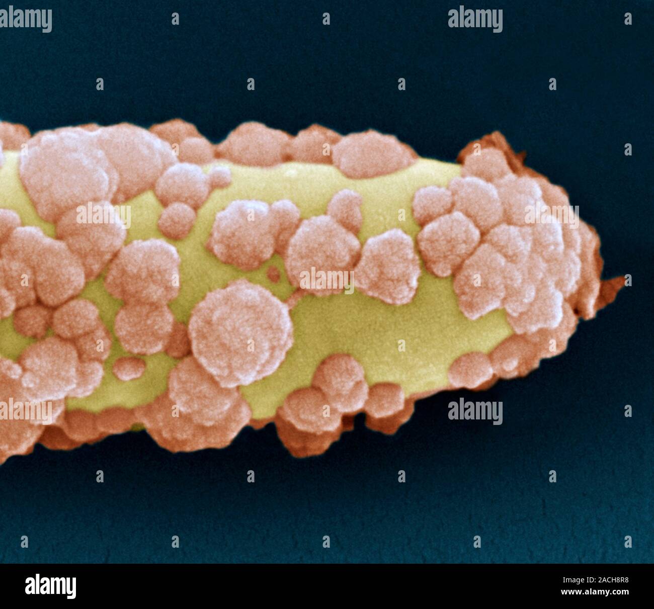Acidovorax bacterium. Coloured scanning electron micrograph (SEM) of an