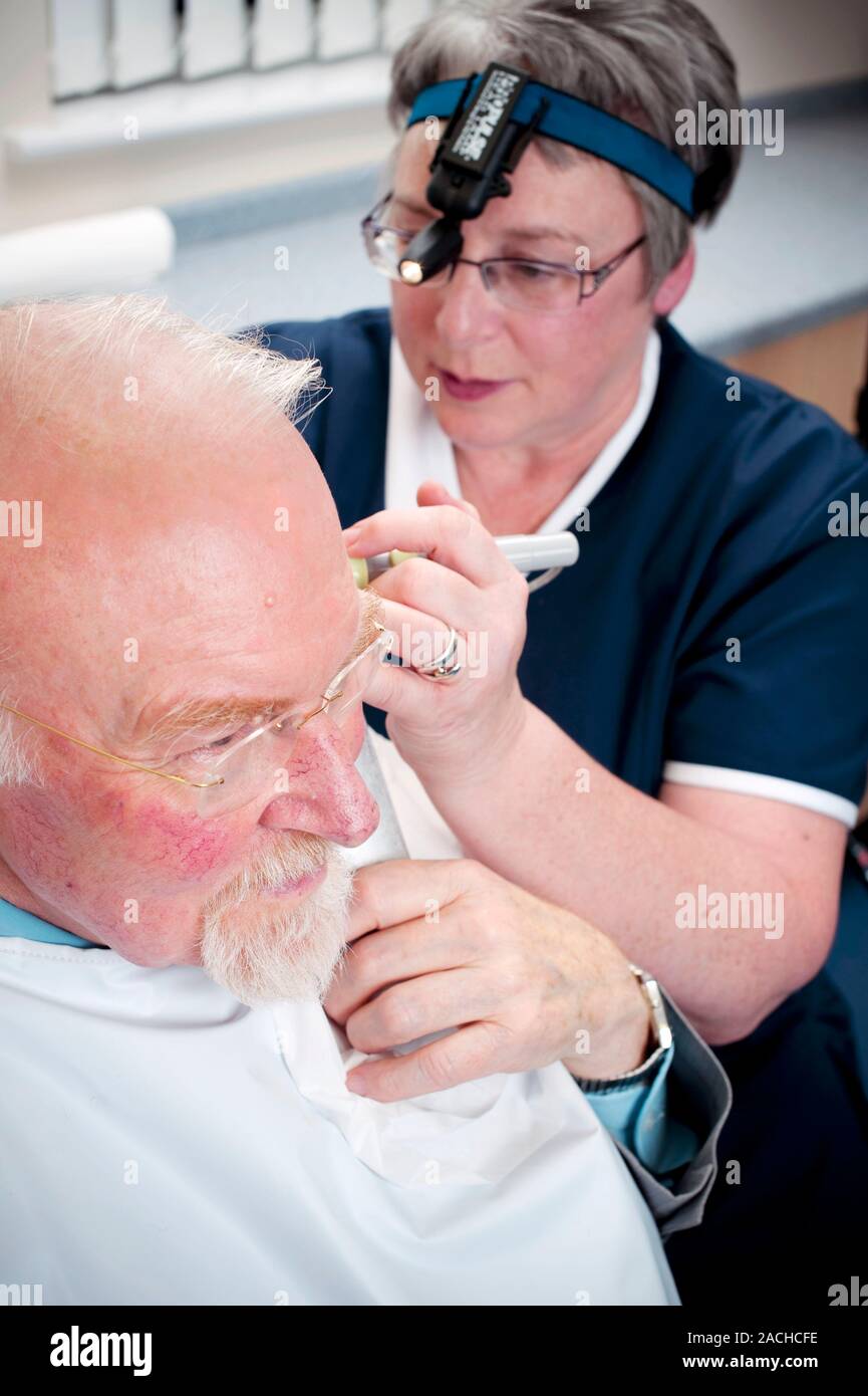 Ear wax removal. Man having his ear syringed at a doctor's surgery