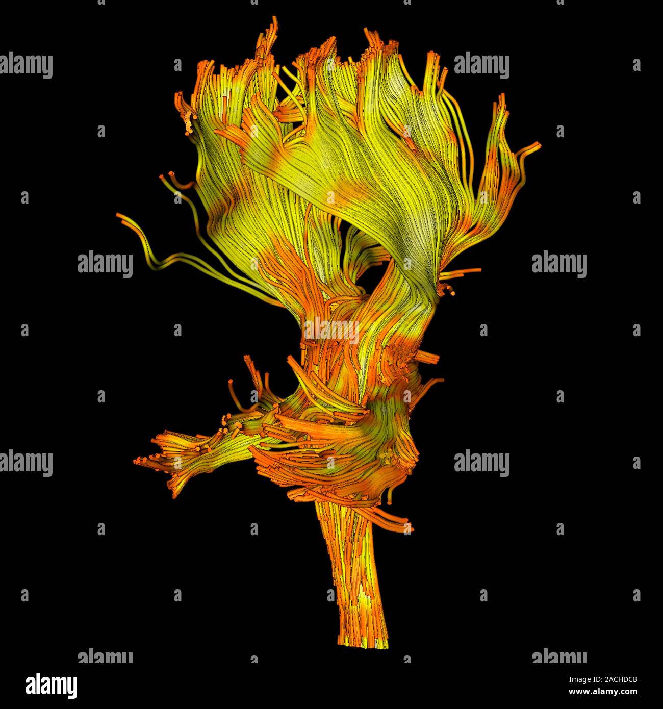 White matter fibres. Coloured 3D diffusion tensor imaging (DTI) scan of ...