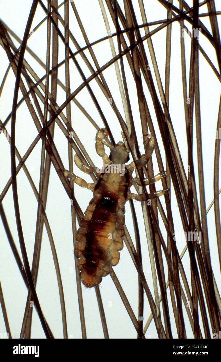 Human hair insects hotsell