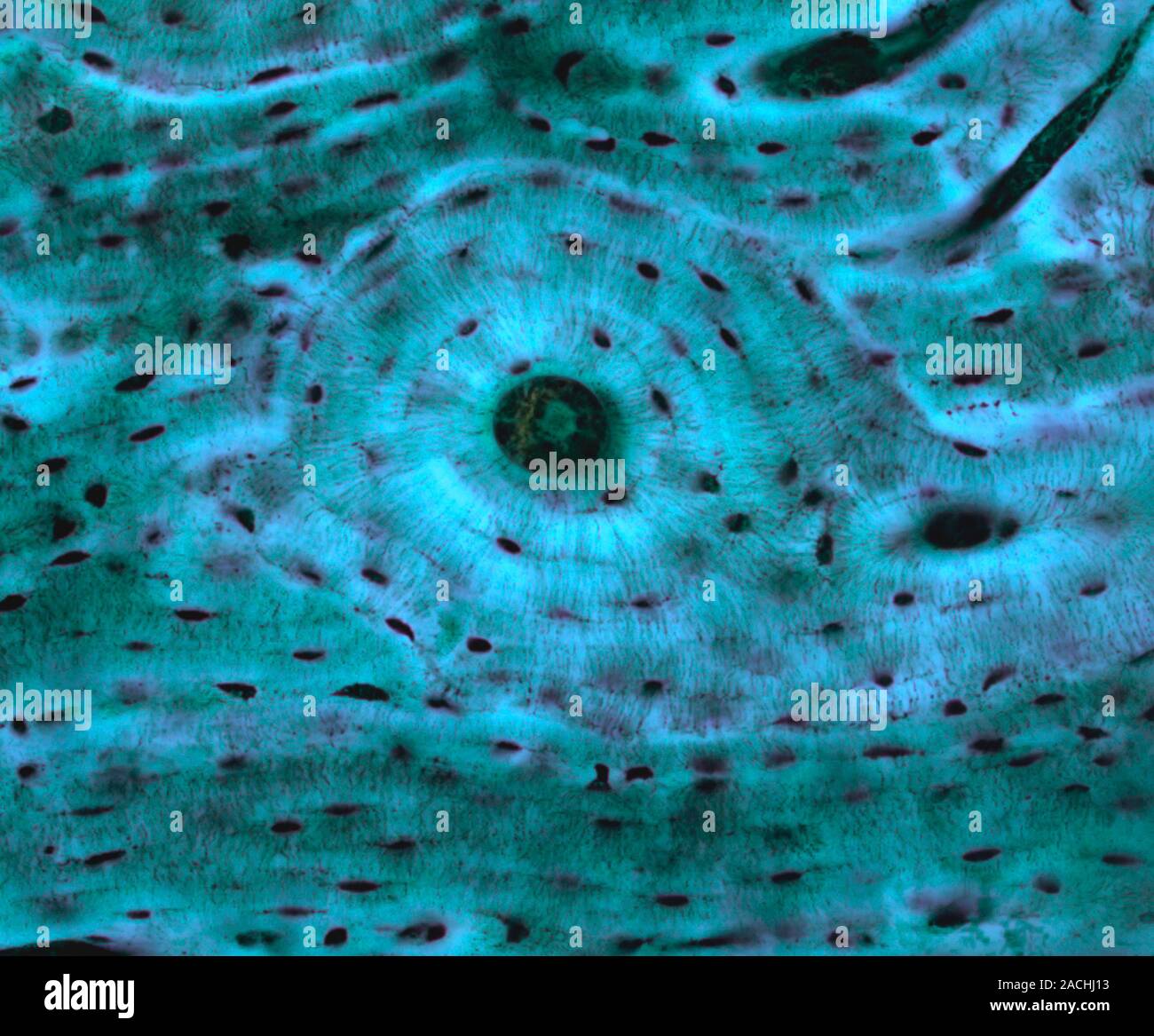 Compact bone, light micrograph. Compact bone consists of concentric ...