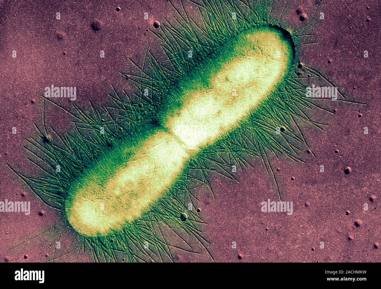 E. coli bacterium. Coloured transmission electron micrograph (TEM) of