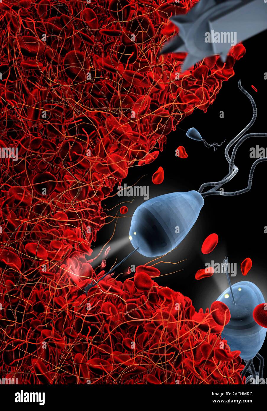 Medical nanorobots. Computer artwork of nanorobots breaking up a blood ...