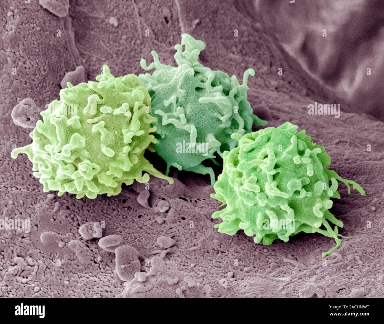 Granulocytes. Coloured scanning electron micrograph (SEM) of