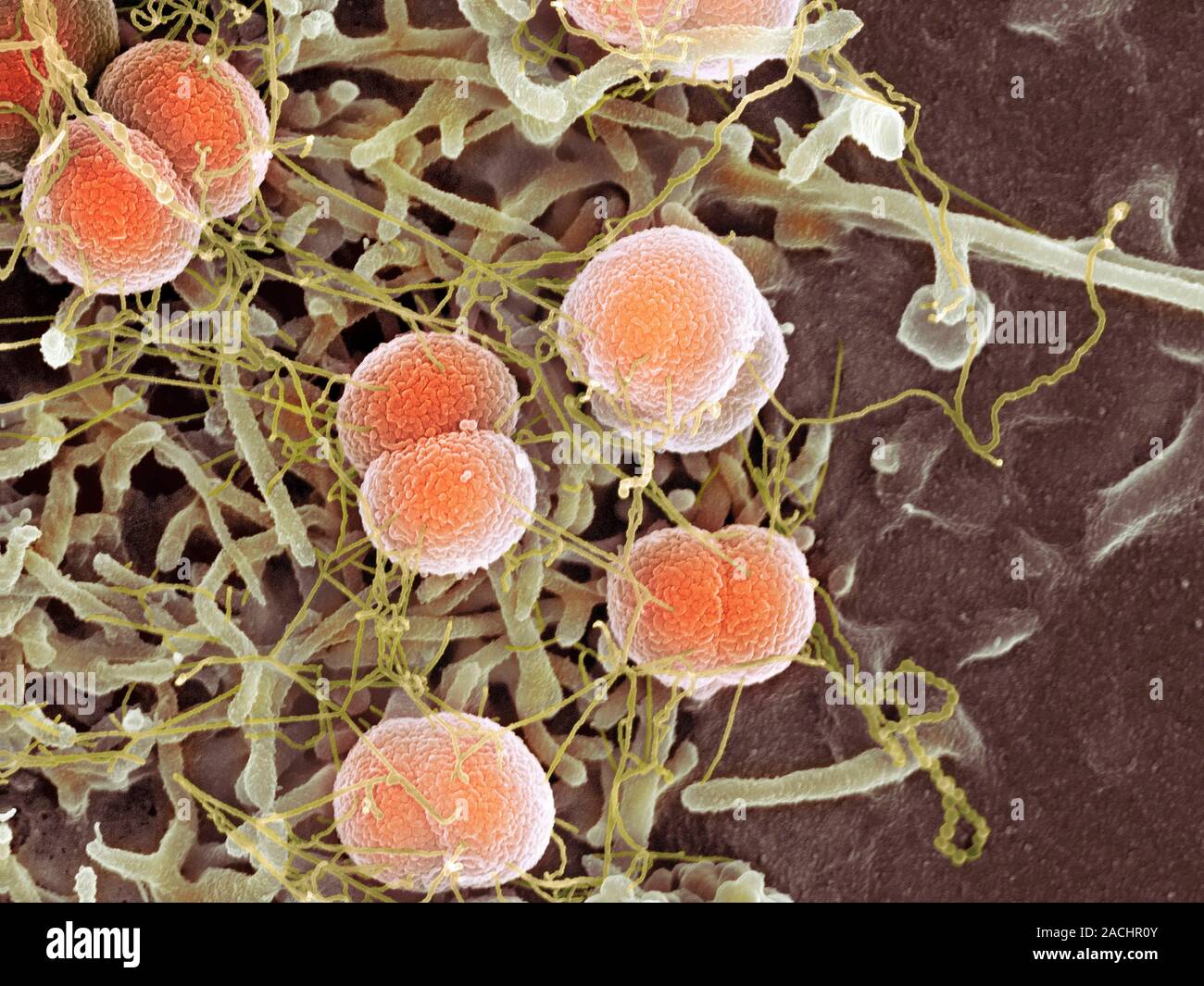 N клетки. Listeria monocytogenes менингит. Менингит питательные среды. Нейссерия менингитидис заболевания.