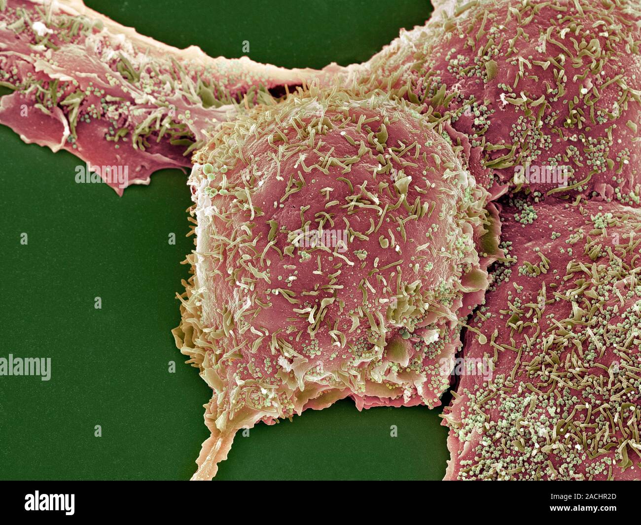 Розовый лишай под микроскопом