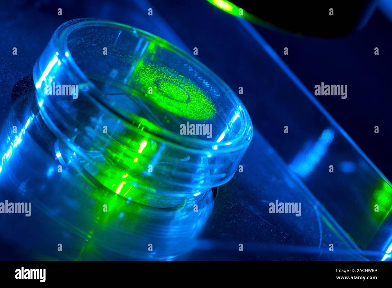Microbiology research. Cultured cells in a petri dish under a ...