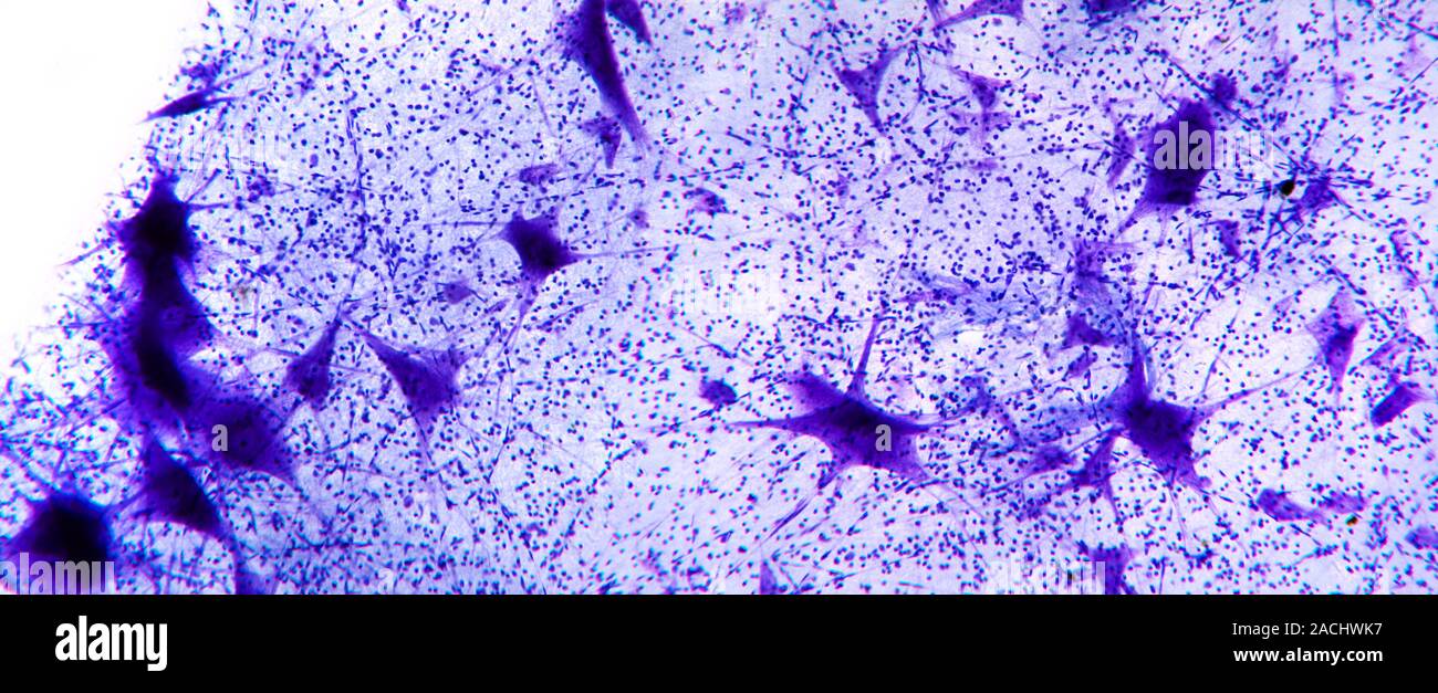 Motor neurones. Light micrograph of motor nerve cells (motor neurones ...