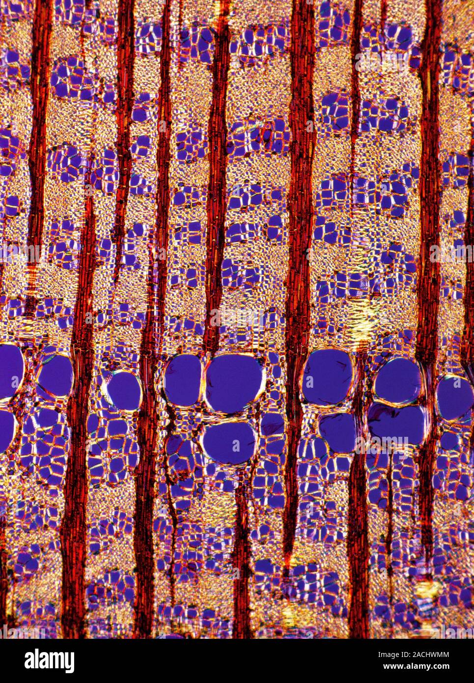 tree-growth-rings-polarised-light-micrograph-of-a-cross-section