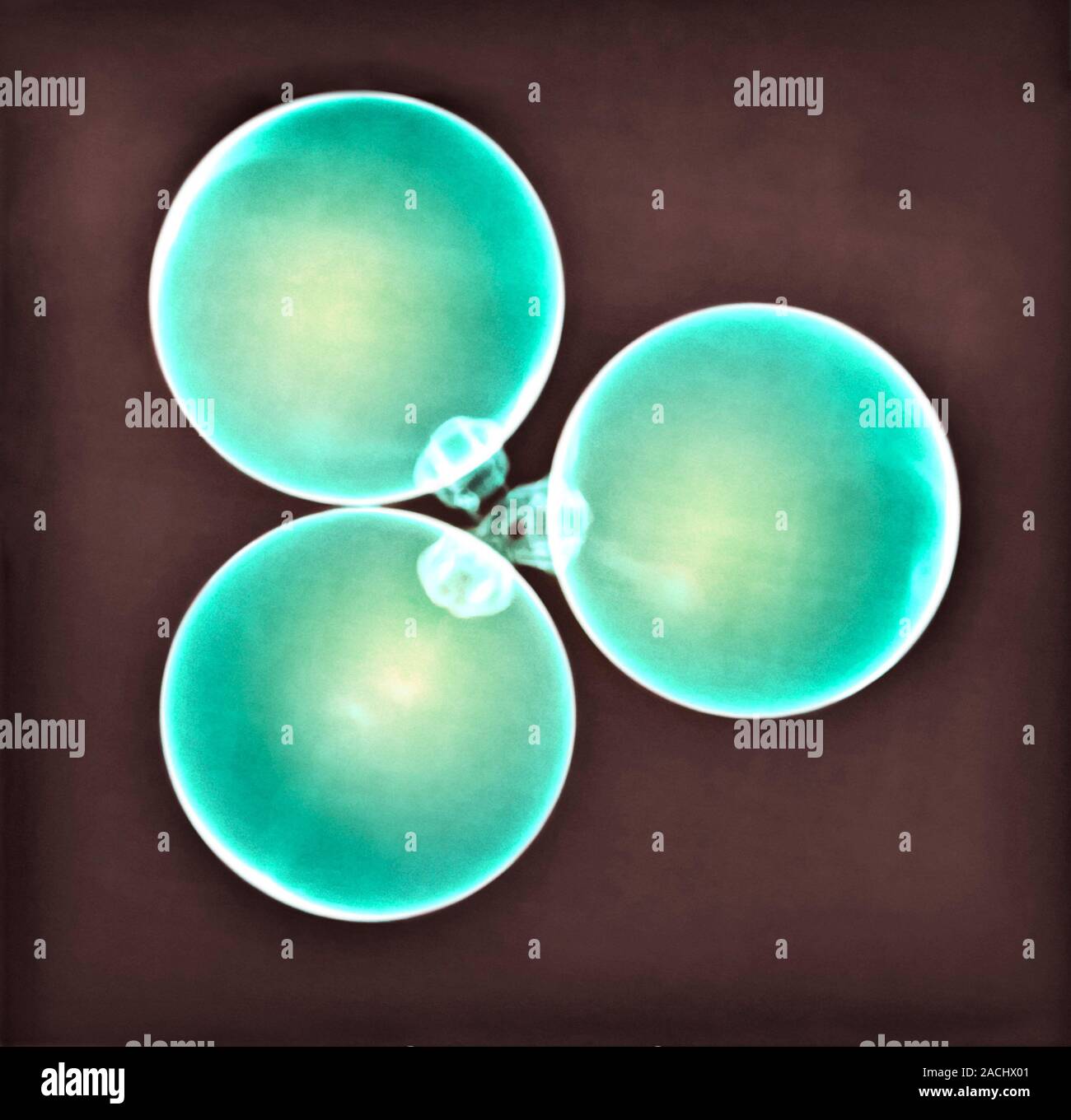 Christmas baubles, X-ray. Stock Photo