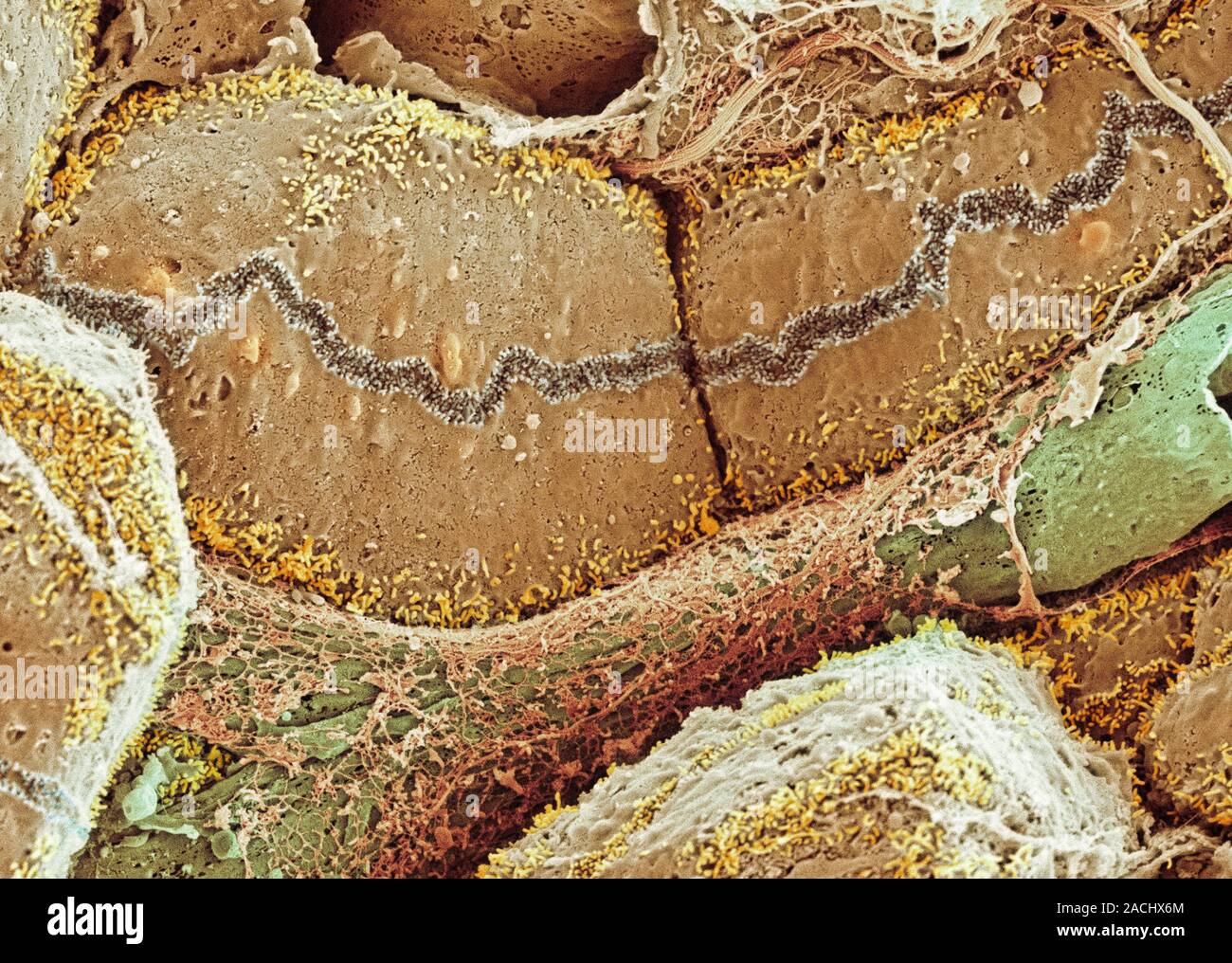 Liver tissue, coloured scanning electron micrograph (SEM). Hepatocytes (liver cells, brown) are specialised epithelial cells and make up approximately Stock Photo