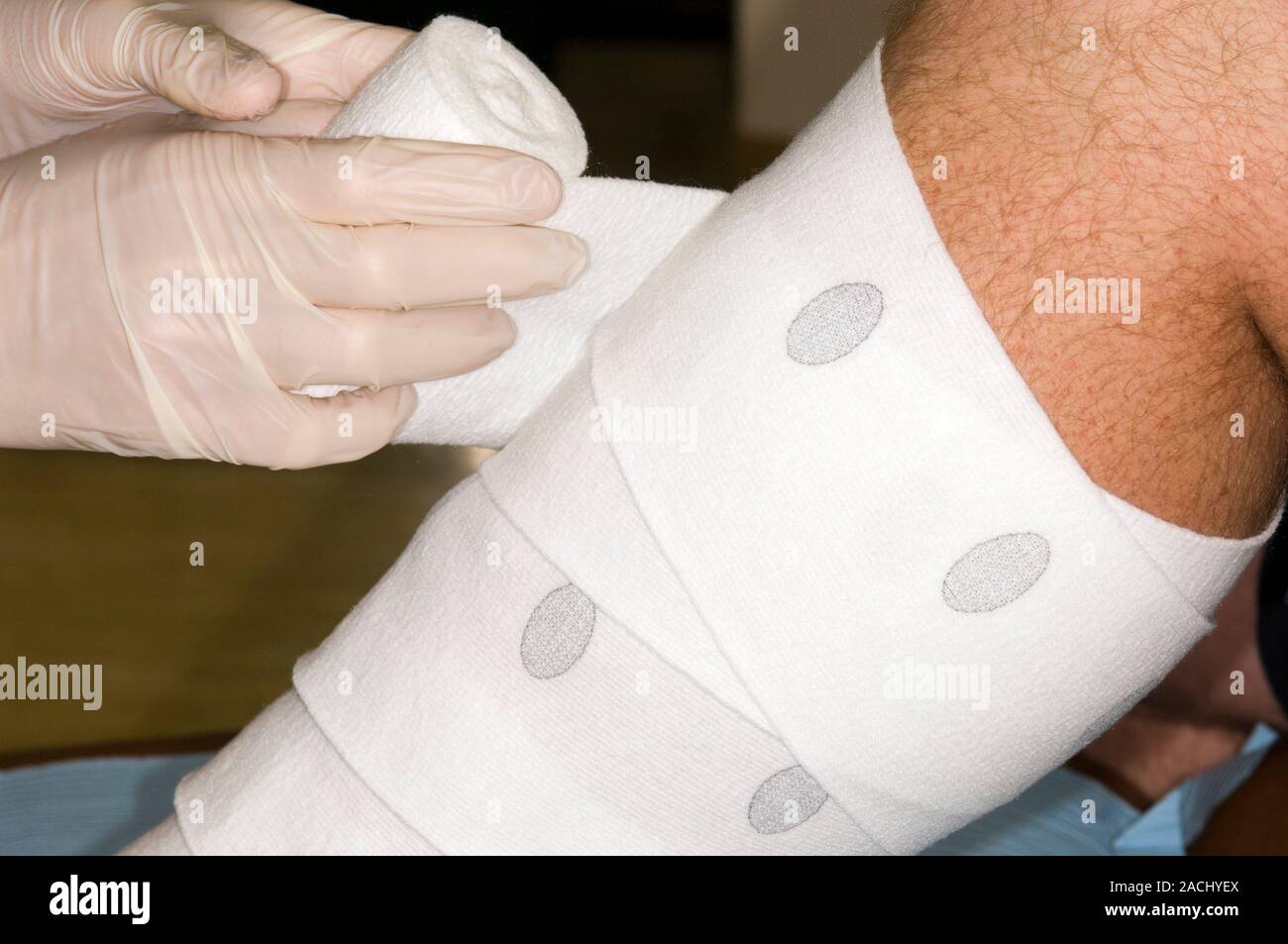 Gloved hands unroll a bandage over sterile gauze to dress the burns on