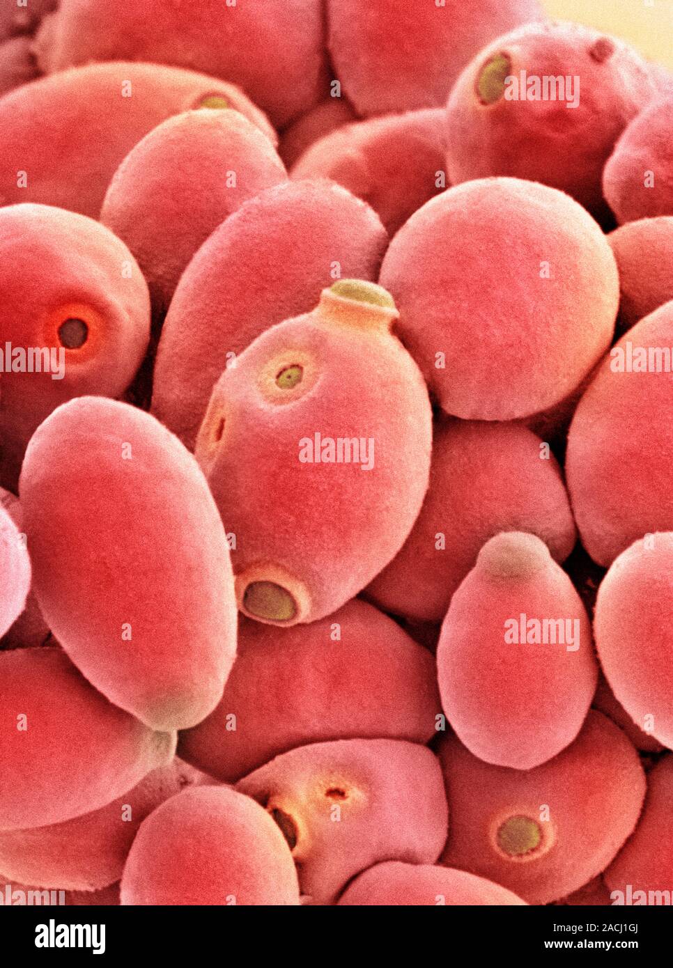 Yeast cells. Coloured scanning electron micrograph (SEM) of cells of