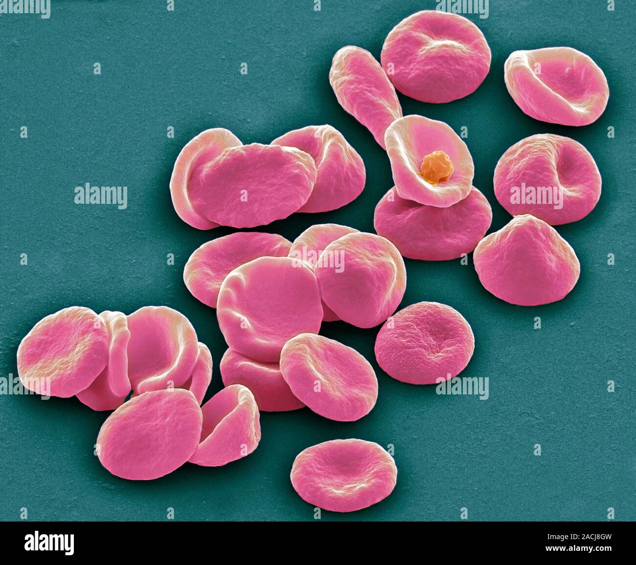 Red blood cells. Coloured scanning electron micrograph (SEM) of human ...