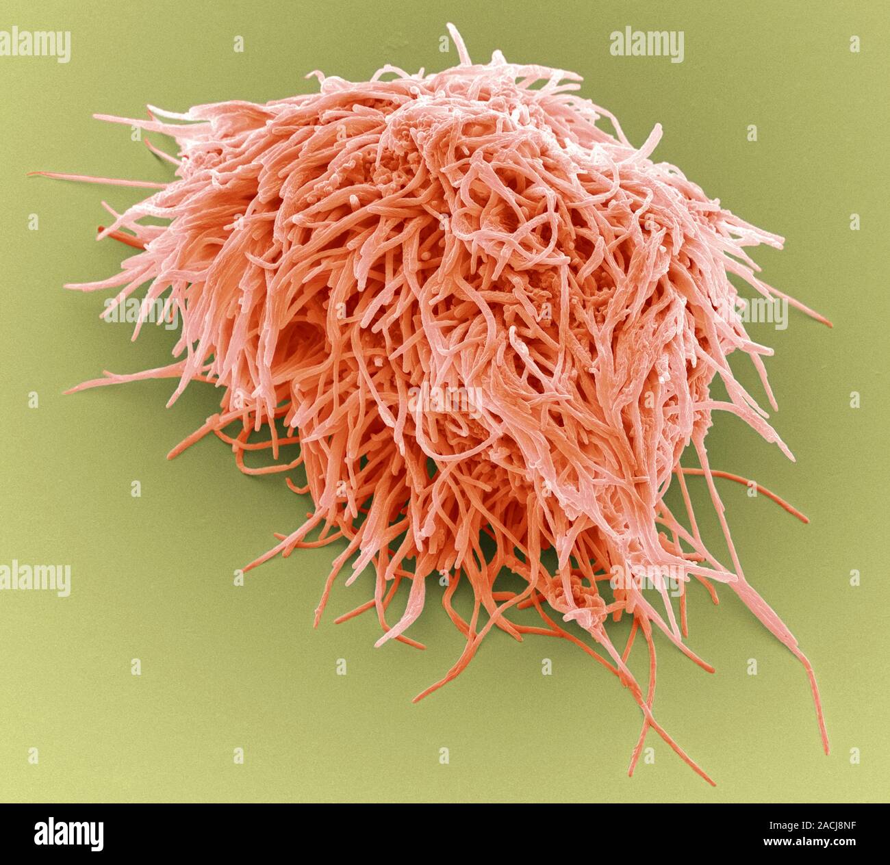 Plaqueforming bacteria, coloured scanning electron micrograph (SEM