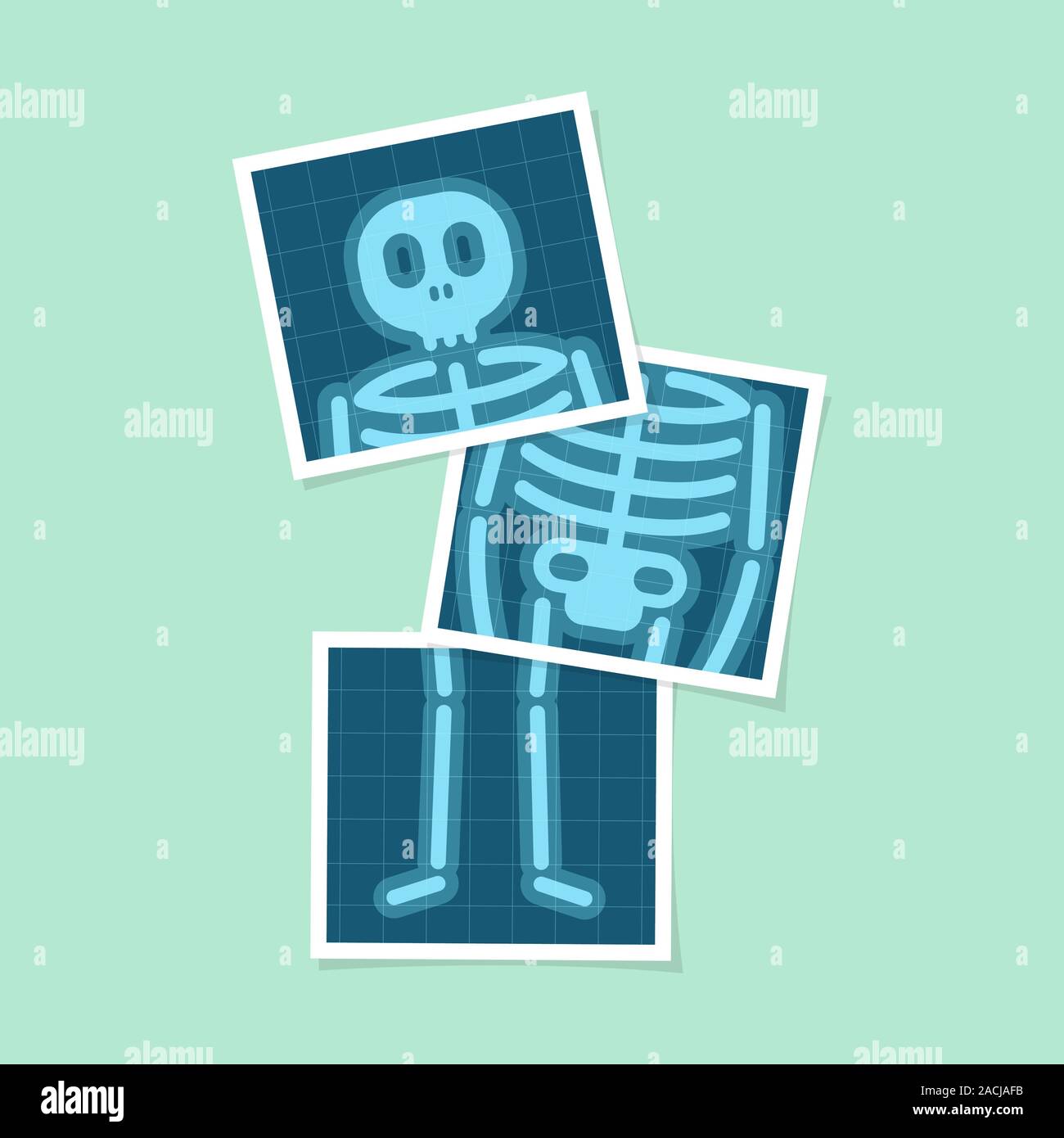 Set of body X-rays film of human body cartoon Stock Vector Image & Art - Alamy Set of body X-rays film of human body cartoon Stock Vector Image & Art - Alamy