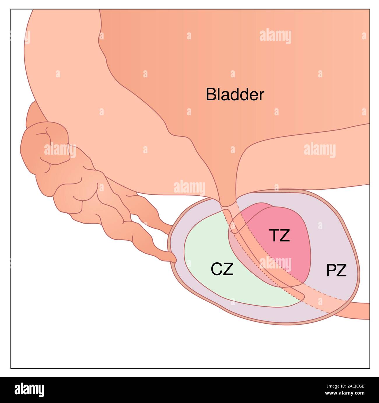Artwork of the anatomy of the prostate gland showing three glandular