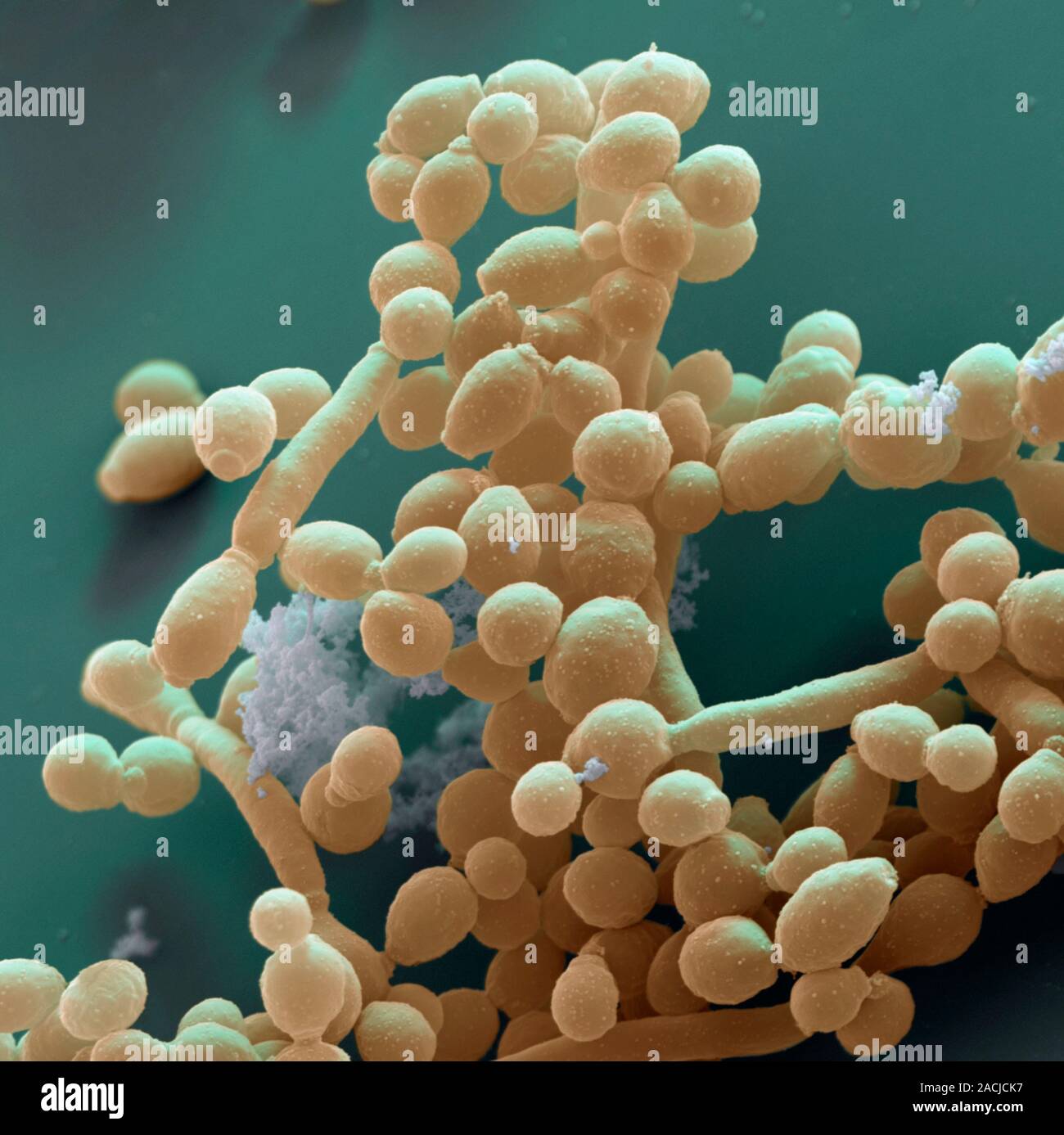 Candida yeast cells, coloured scanning electron micrograph (SEM). This