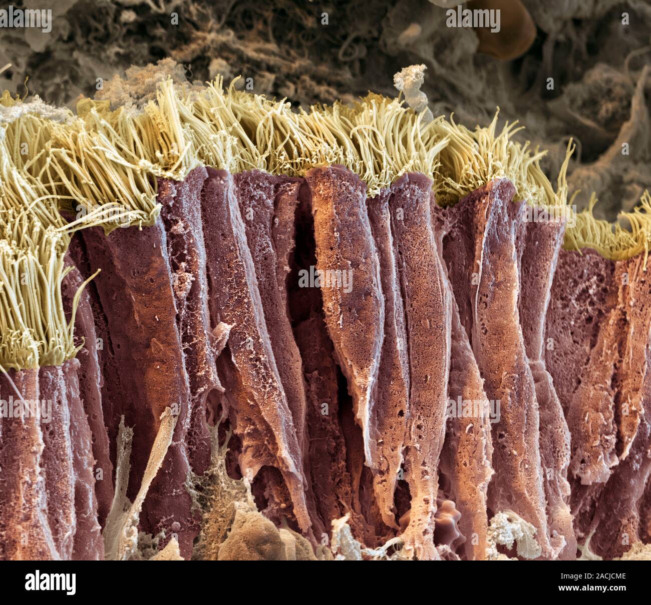 Lung Epithelial Cell Coloured Scanning Electron Micrograph Sem Of A