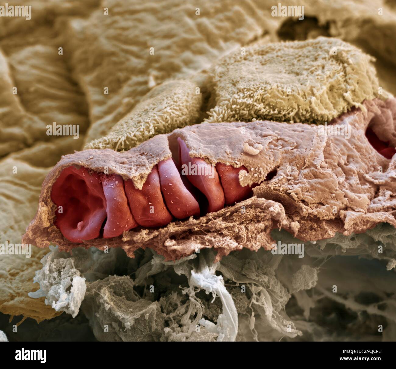 Lung capillary. Coloured scanning electron micrograph (SEM) of a broken ...