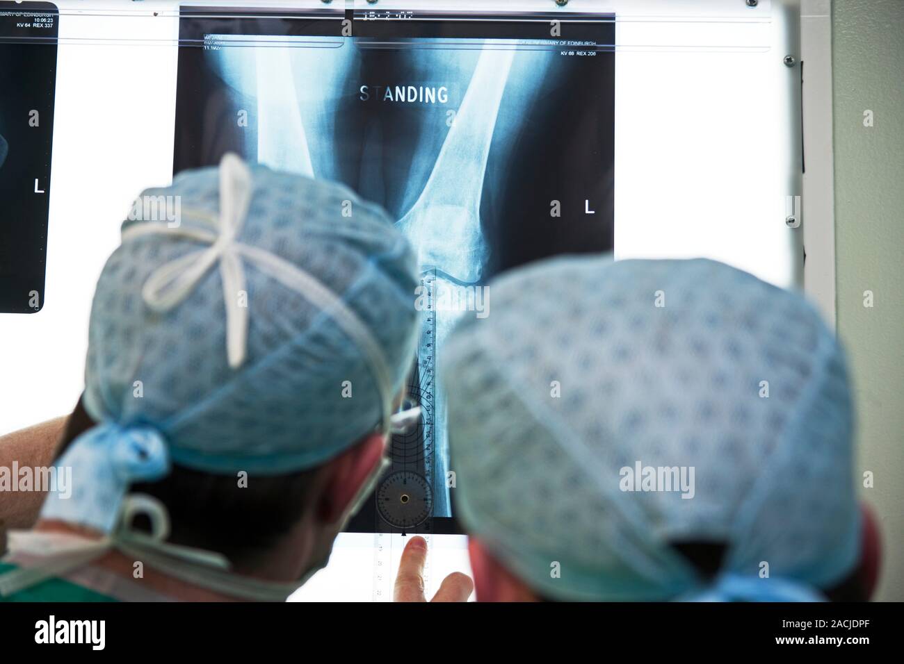 Orthopaedic surgeons discussing patient's Xrays before knee