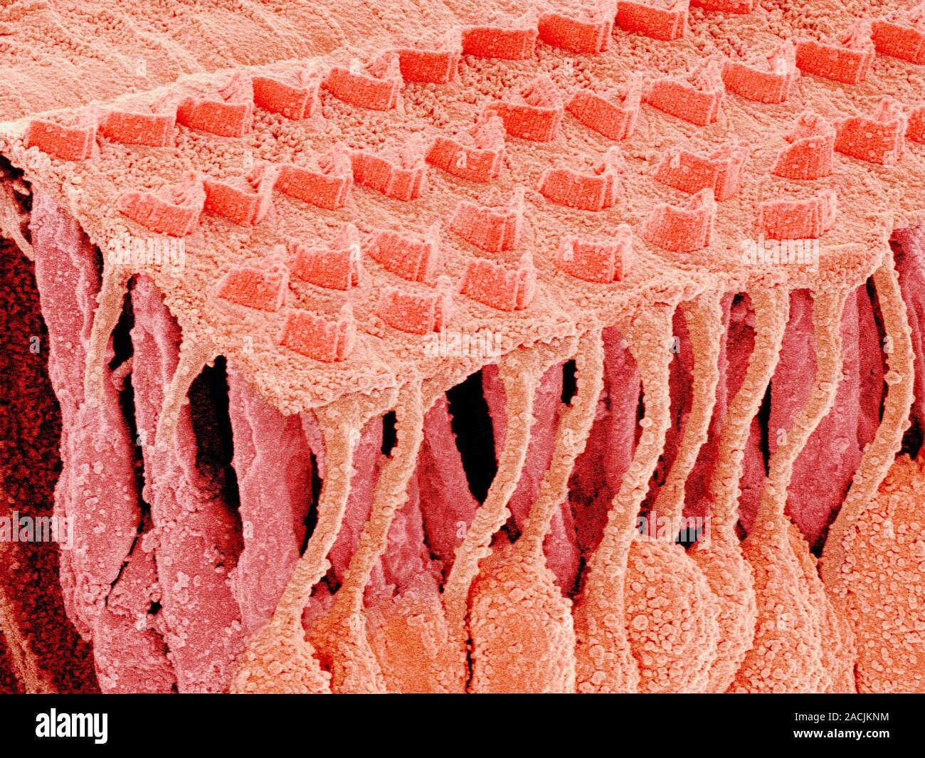 Клетки волосков улитки. Макула волосковые клетки. Волосковые клетки улитки. Волосковые слуховые клетки. Наружные волосковые клетки.