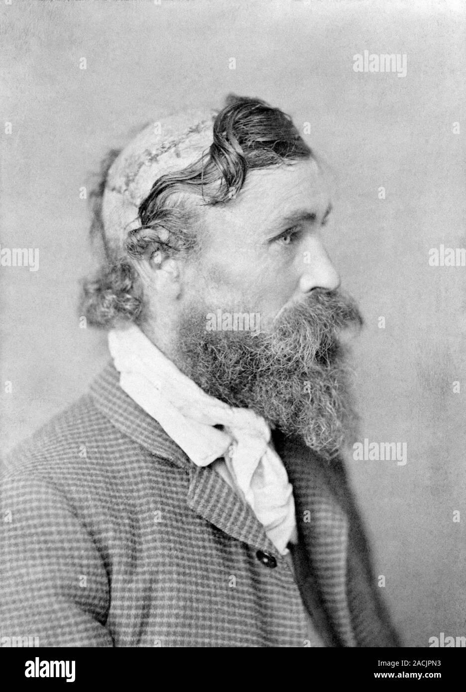 Robert McGee, scalping victim. This photograph, taken circa 1890, shows ...