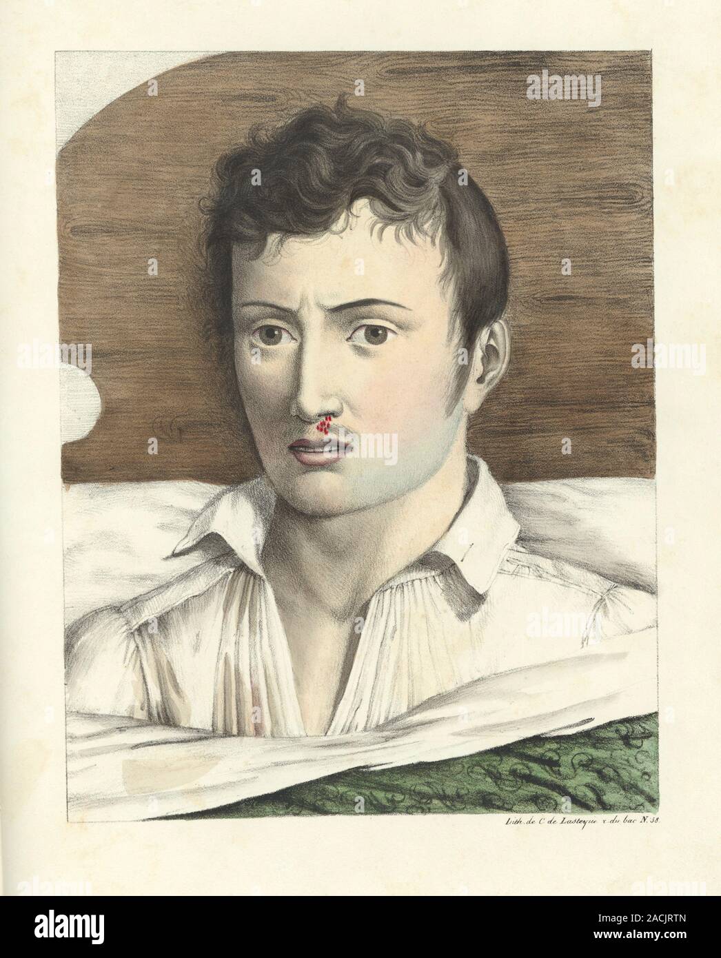 Yellow fever sequence. This portrait, the third in a sequence of four