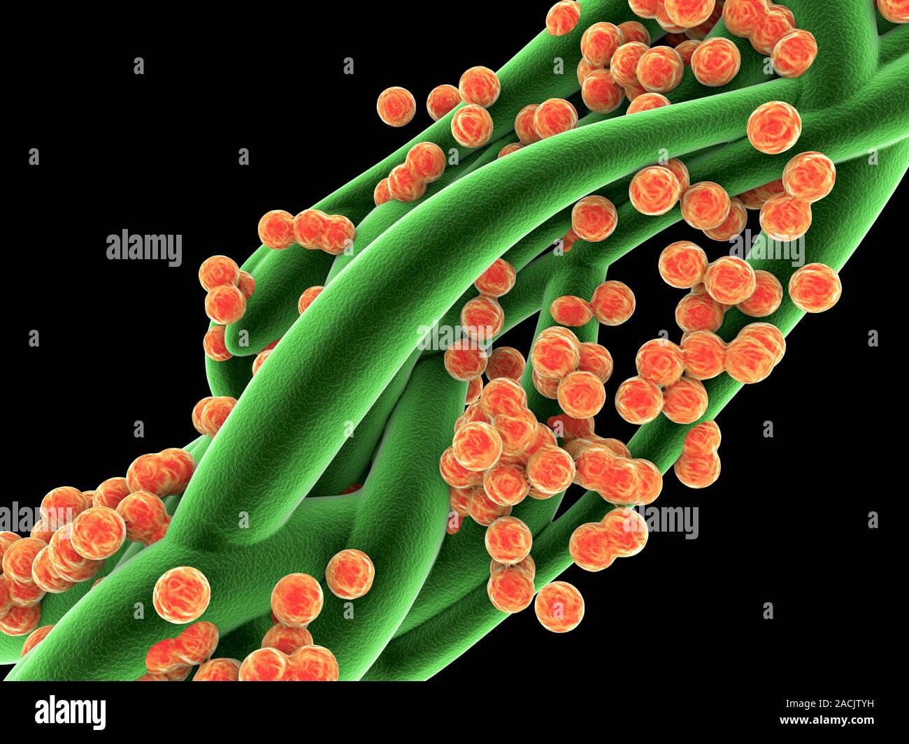 Intoxicatia. стафилококк излечимый. Prsa стафилококки. ротавирусный стафилококк. стафилококк в желудке.