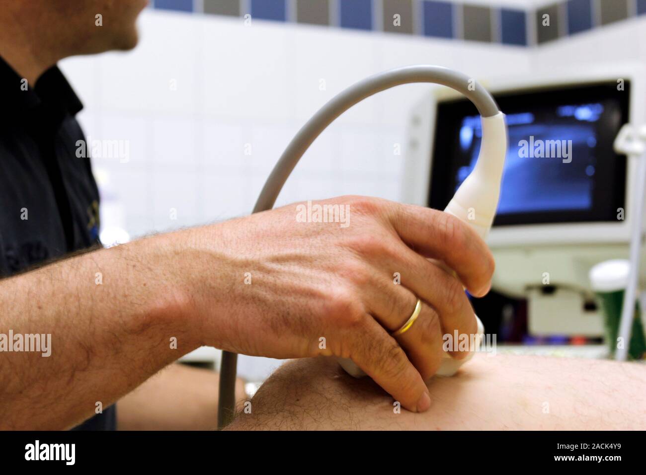 Orthopaedics. Orthopaedic surgeon using an ultrasound machine to check
