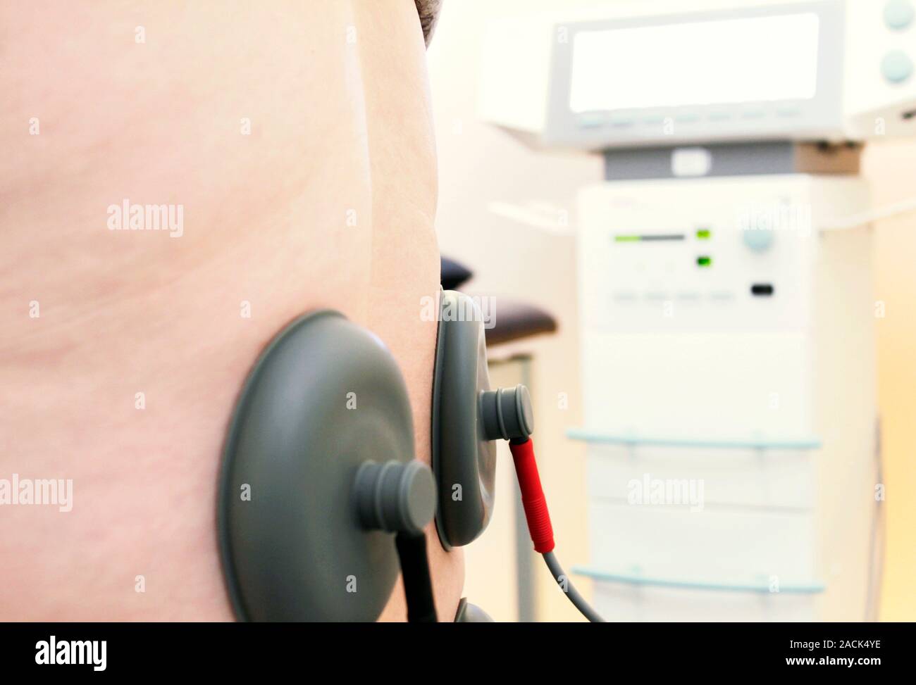 Orthopaedics. Patient attached to a machine to treat their back Stock ...