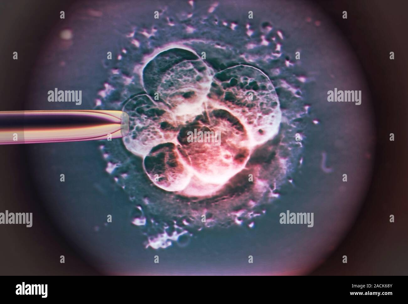 IVF embryo. Coloured light micrograph of a human embryo 48-72 hours ...