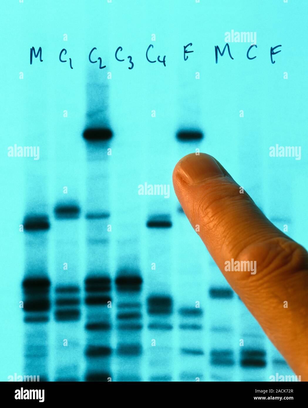 Part of an Xray (or autoradiograph) of bands of DNA produced by the