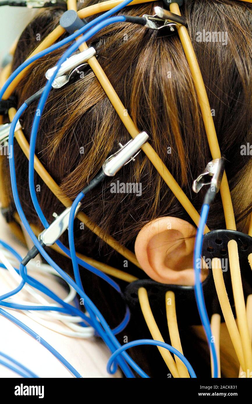 Neurological testing. Closeup of electrodes on the head of a patient
