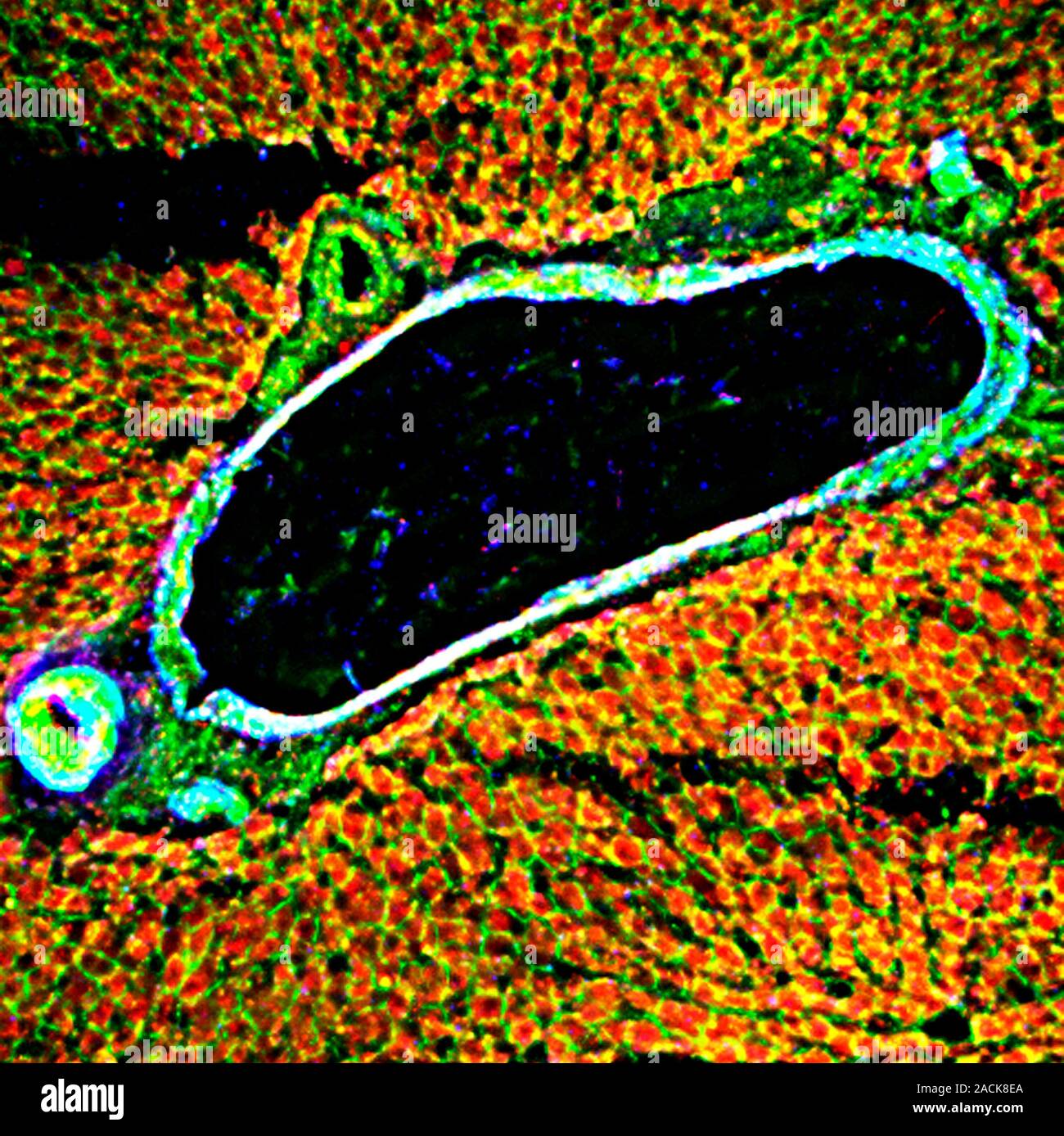 Liver tissue. Fluorescence deconvolution micrograph of a section ...