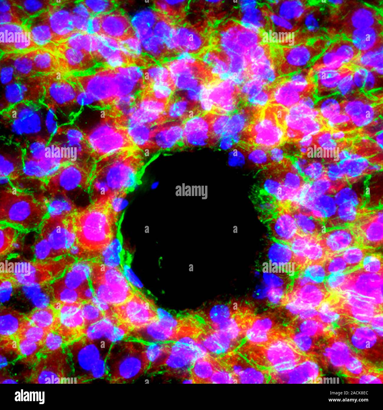 Liver tissue. Fluorescence deconvolution micrograph of a section ...