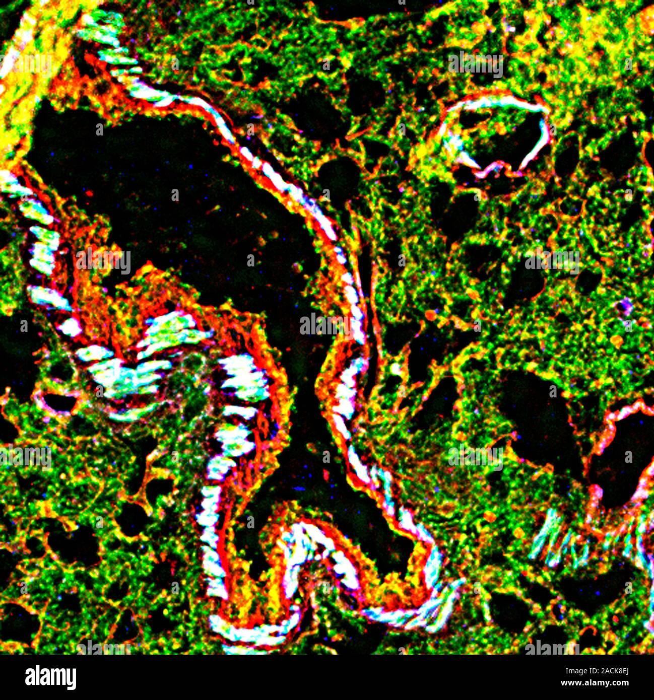 Lung tissue. Fluorescence deconvolution micrograph of a section through ...