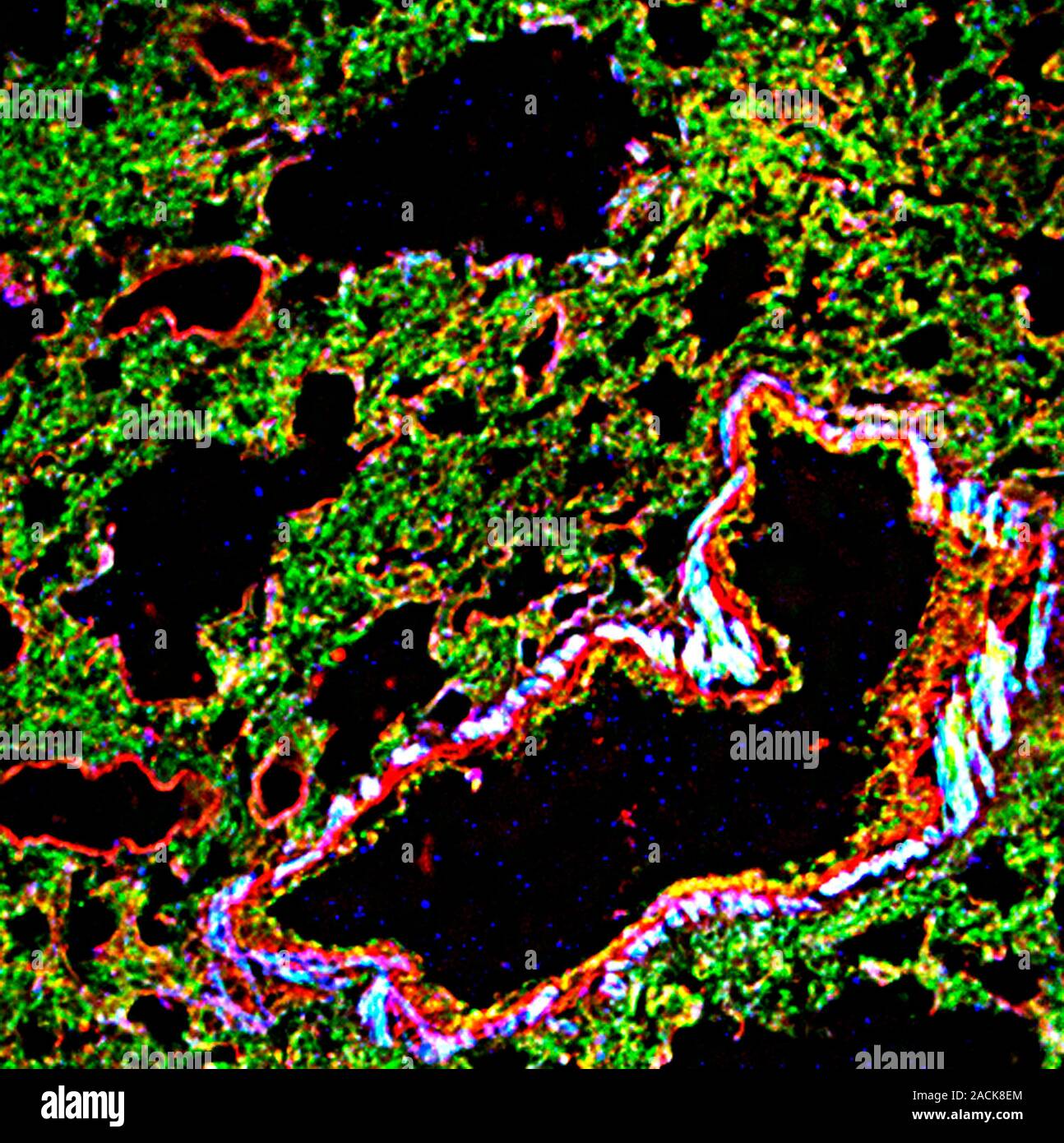 Lung tissue. Fluorescence deconvolution micrograph of a section through ...