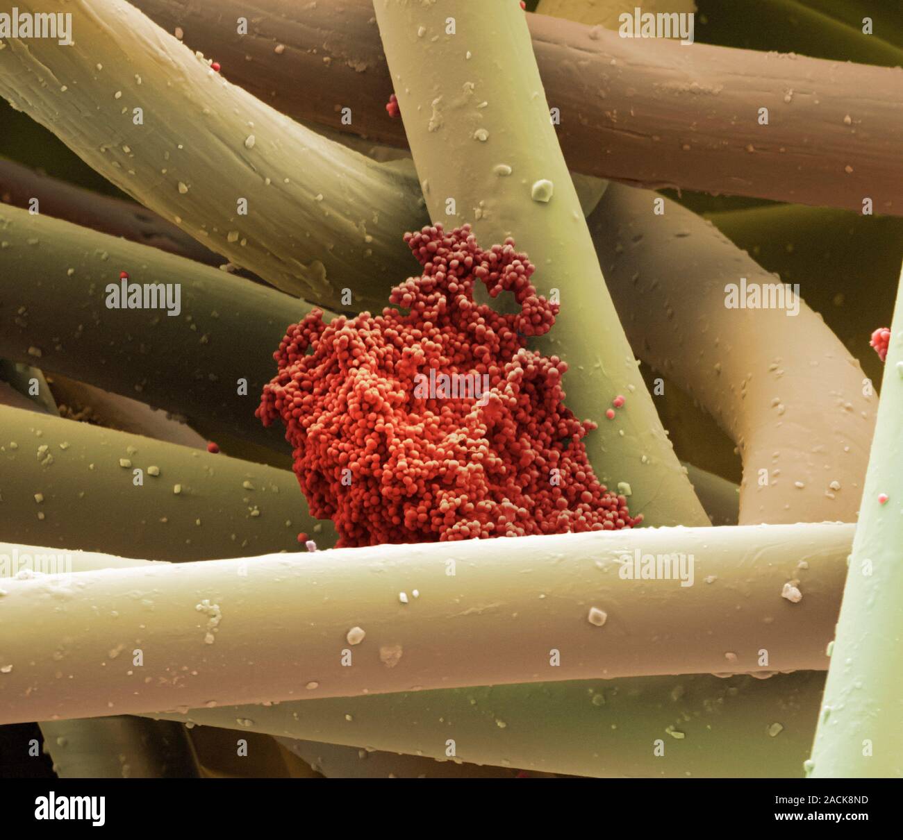 MRSA bacteria. Coloured scanning electron micrograph (SEM) of ...