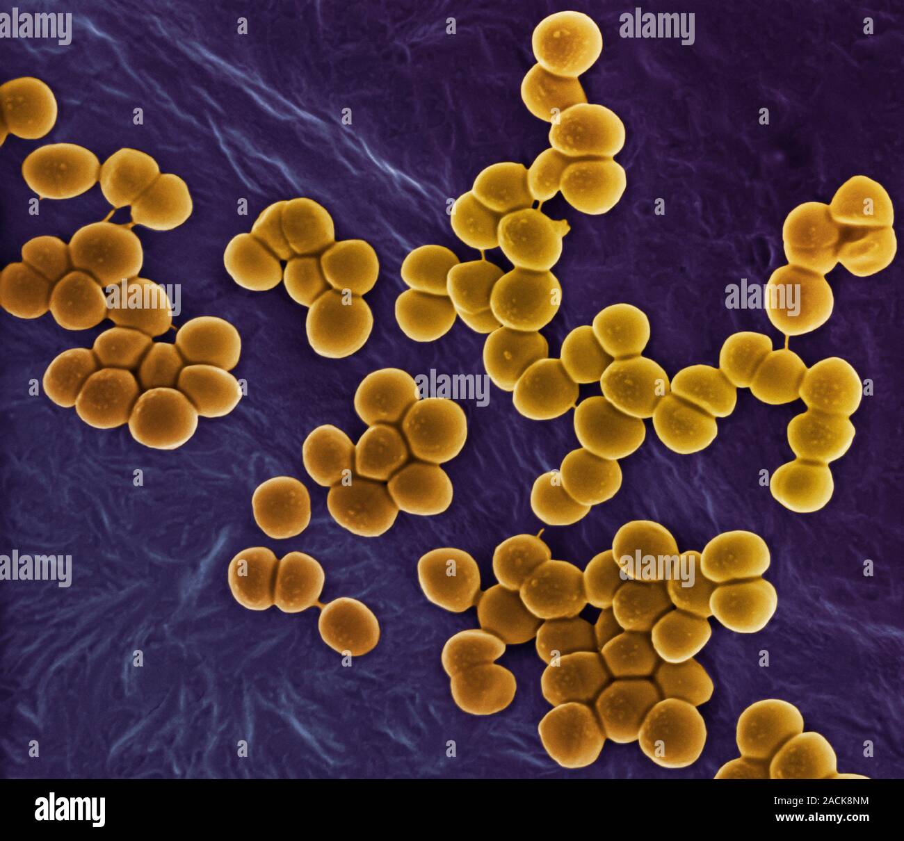 MRSA bacteria. Coloured scanning electron micrograph (SEM) of ...