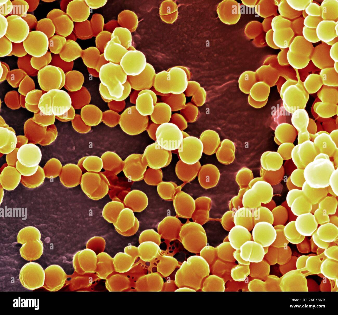 Стафилококк ауреус. Метициллин-резистентный золотистый стафилококк. Стафилококк золотистый Staphylococcus aureus. Золотистый стафилококк MRSA. Бактерия стафилококк ауреус.
