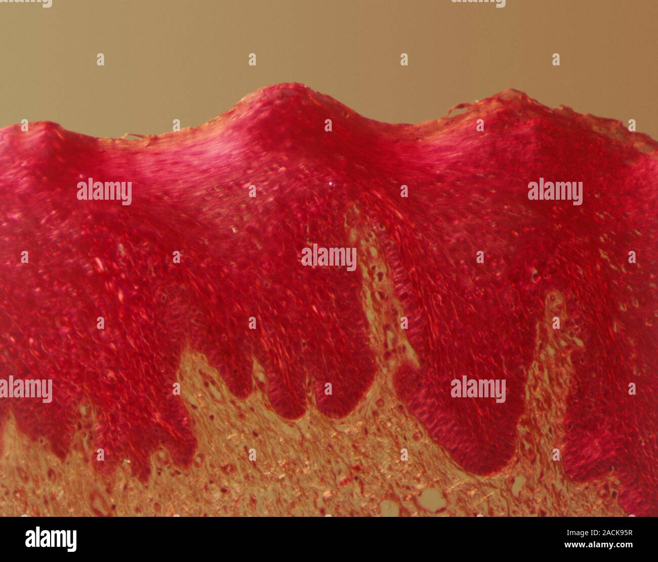 Tongue tissue, light micrograph. Section through the surface of the
