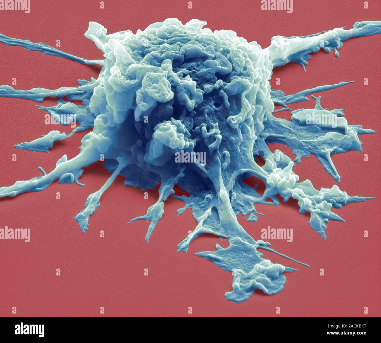 Активность макрофагов. Макрофаги это клетки. Фагоциты и макрофаги. Дендритные клетки фагоциты. Макрофаги электронная микроскопия.