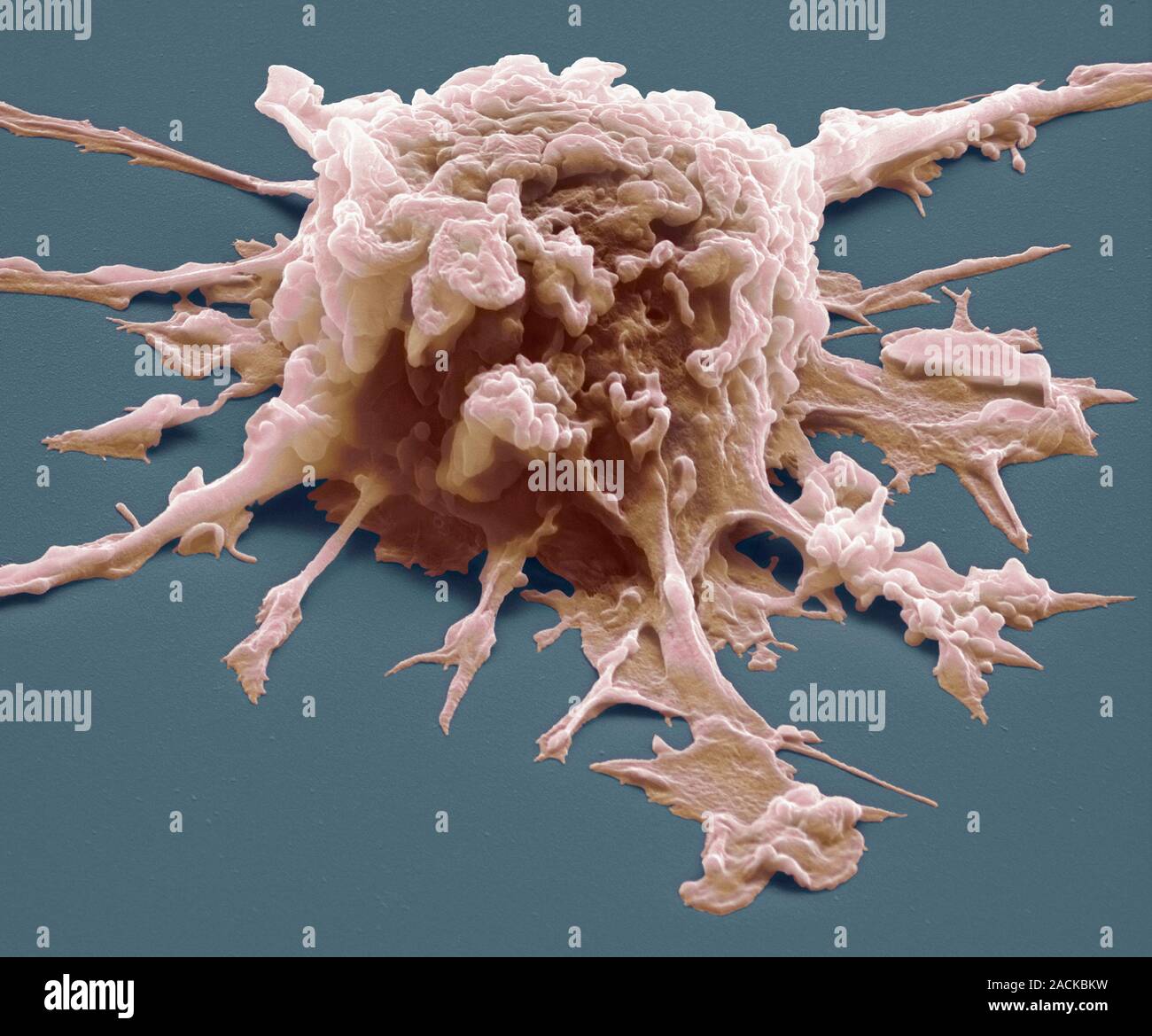 Макрофаги 2 3. Макрофаги микробиология. Макрофаги электронная микроскопия. Гранулярные макрофаги. Макрофаг в микроскопе.