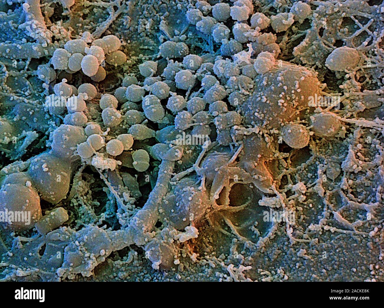Dental plaque. Coloured scanning electron micrograph (SEM) of dental